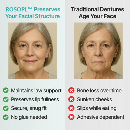 🌎Ends Today: 70% OFF! - Custom-Fit Full Functional Dentures Make you more confident✨