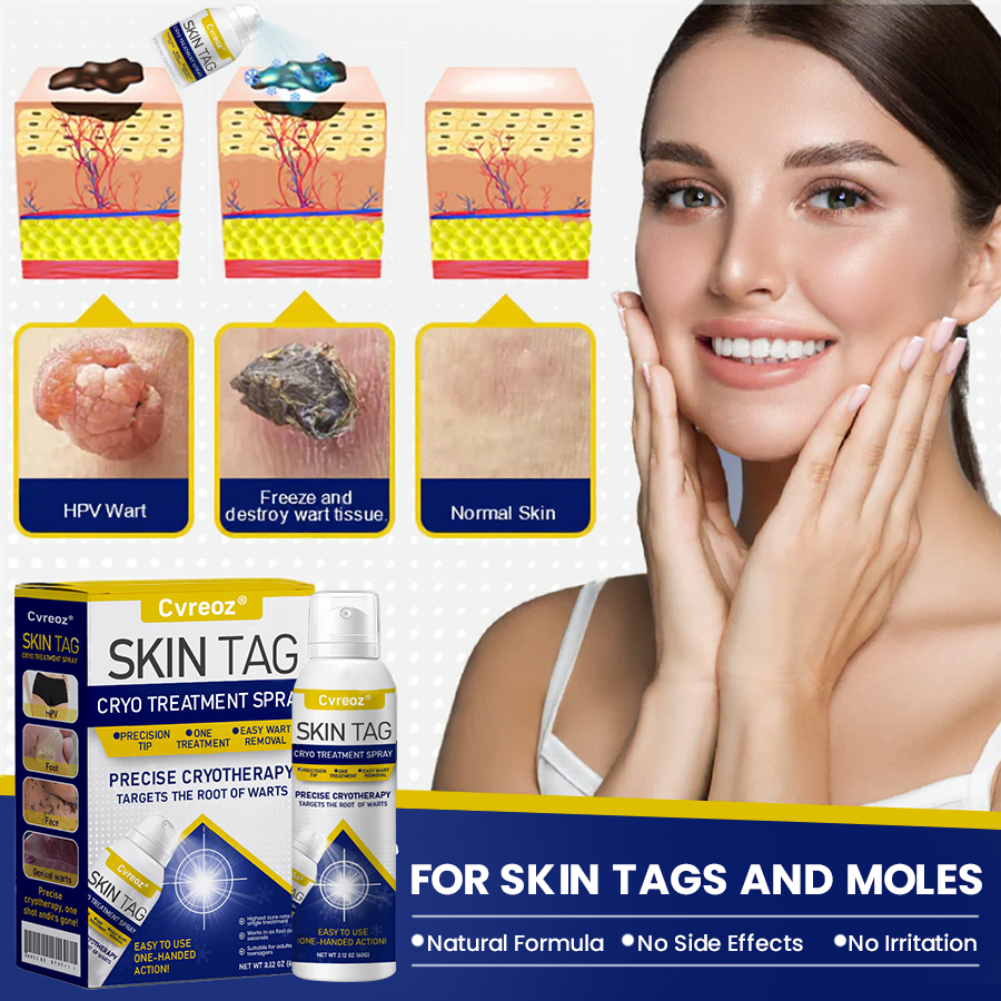 🎉SPECIAL OFFER: 60% OFF This Week Only!🔥 Skin Tag Cryo Treatment Spray