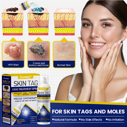 🎉SPECIAL OFFER: 60% OFF This Week Only!🔥 Skin Tag Cryo Treatment Spray