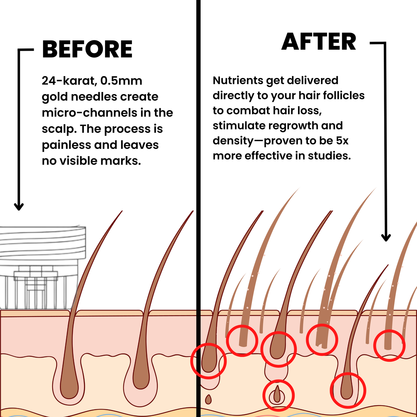 Ascendrtop™ Hair Regrowth System