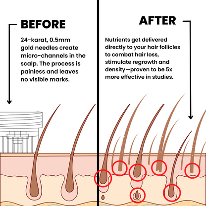 Ascendrtop™ Hair Regrowth System
