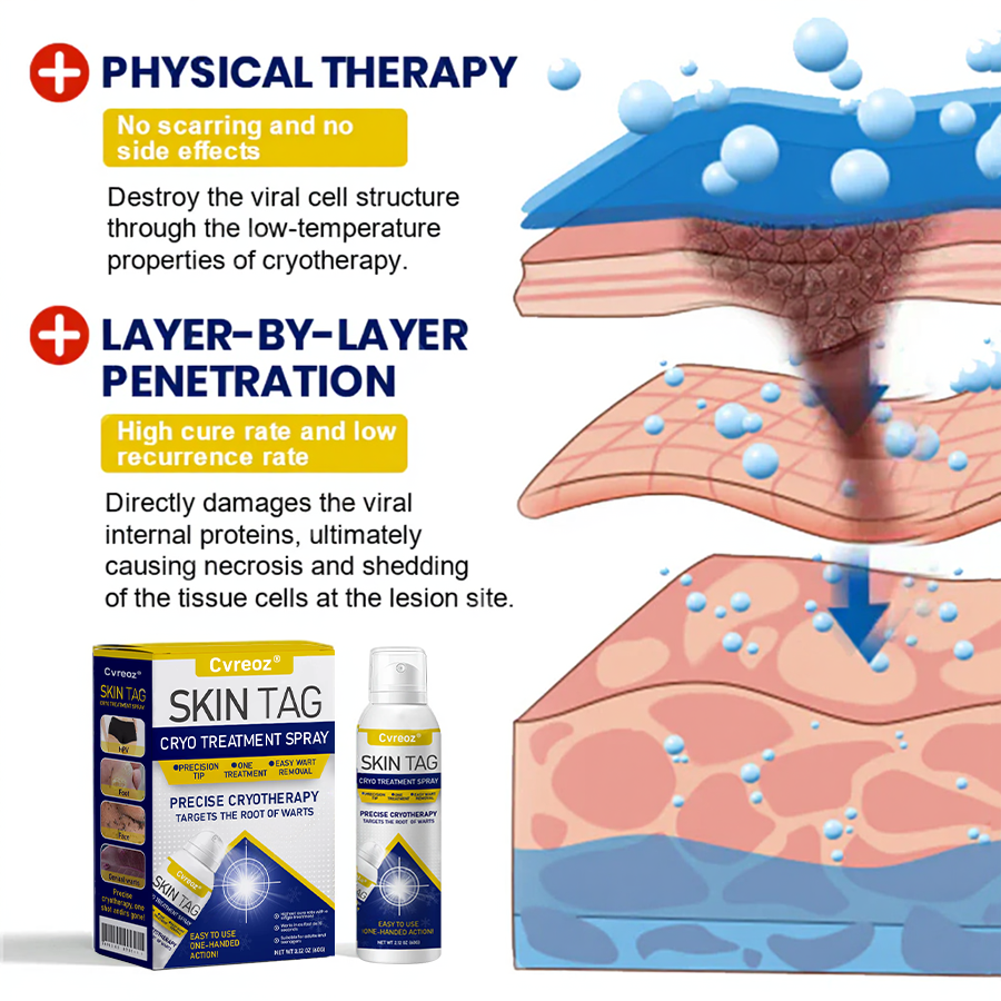 🎉SPECIAL OFFER: 60% OFF This Week Only!🔥 Skin Tag Cryo Treatment Spray
